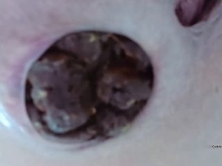 Preview 6