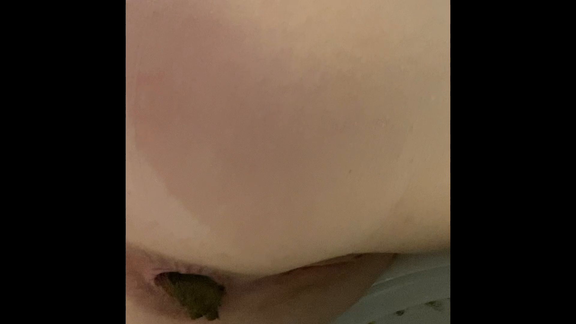 Foxness – POOPING! a series – episode 9